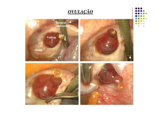 OVULAÇÃO
 