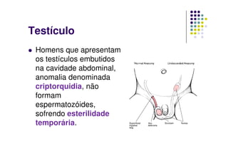 Testículo
 Homens que apresentam
 os testículos embutidos
 na cavidade abdominal,
 anomalia denominada
 criptorquidia, não
 formam
 espermatozóides,
 sofrendo esterilidade
 temporária.
 