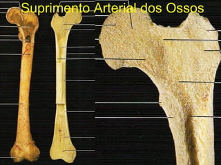 Suprimento Arterial dos Ossos 