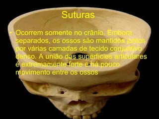 Suturas  Ocorrem somente no crânio. Embora separados, os ossos são mantidos juntos por várias camadas de tecido conjuntivo denso. A união das superfícies articulares é extremamente forte e há pouco movimento entre os ossos 