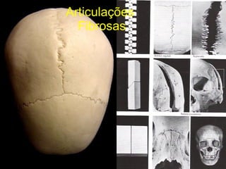 Articulações  Fibrosas 