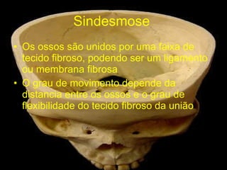 Sindesmose  Os ossos são unidos por uma faixa de tecido fibroso, podendo ser um ligamento ou membrana fibrosa O grau de movimento depende da distancia entre os ossos e o grau de flexibilidade do tecido fibroso da união  