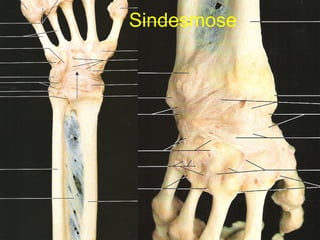Sindesmose  