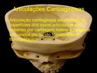 Articulações Cartilaginosas Articulação cartilaginosa secundária: as superfícies dos ossos articulados são cobertas por cartilagem hialina e os ossos são unidos por tecido fibroso forte ou fibrocartilagem 