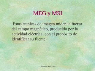 MEG y MSI
Estas técnicas de imagen miden la fuerza
del campo magnético, producido por la
actividad eléctrica, con el propósito de
identificar su fuente.

©Prentice Hall, 1999

 