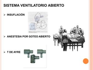 SISTEMA VENTILATORIO ABIERTO
 INSUFLACIÓN
 ANESTESIA POR GOTEO ABIERTO
 T DE AYRE
 