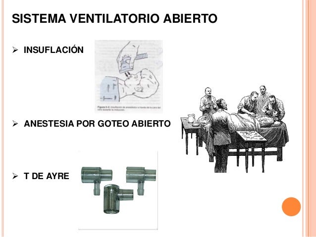 Sistemas y circuitos anestésicos