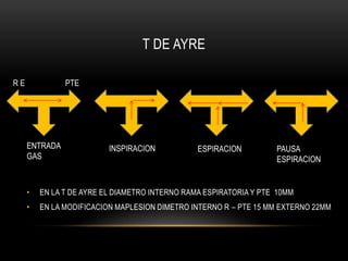 T DE AYRE

RE             PTE




     ENTRADA              INSPIRACION           ESPIRACION         PAUSA
     GAS                                                           ESPIRACION


     •   EN LA T DE AYRE EL DIAMETRO INTERNO RAMA ESPIRATORIA Y PTE 10MM
     •   EN LA MODIFICACION MAPLESION DIMETRO INTERNO R – PTE 15 MM EXTERNO 22MM
 