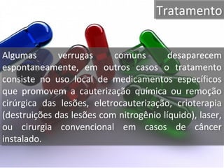 TratamentoTratamento
Algumas verrugas comuns desaparecem
espontaneamente, em outros casos o tratamento
consiste no uso local de medicamentos específicos
que promovem a cauterização química ou remoção
cirúrgica das lesões, eletrocauterização, crioterapia
(destruições das lesões com nitrogênio líquido), laser,
ou cirurgia convencional em casos de câncer
instalado.
Algumas verrugas comuns desaparecem
espontaneamente, em outros casos o tratamento
consiste no uso local de medicamentos específicos
que promovem a cauterização química ou remoção
cirúrgica das lesões, eletrocauterização, crioterapia
(destruições das lesões com nitrogênio líquido), laser,
ou cirurgia convencional em casos de câncer
instalado.
 