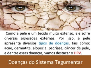 Doenças do Sistema TegumentarDoenças do Sistema Tegumentar
Como a pele é um tecido muito extenso, ele sofre
diversas agressões externas. Por isso, a pele
apresenta diversos tipos de doenças, tais como:
acne, dermatite, alopecia, psoríase, câncer de pele,
e dentre essas doenças, vamos destacar o HPV.
 