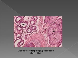 Glândulas: sudorípara (Su) e sebácea
(Se) (100x).
 