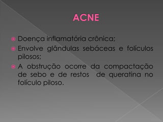  Doença inflamatória crônica;
 Envolve glândulas sebáceas e folículos
pilosos;
 A obstrução ocorre da compactação
de sebo e de restos de queratina no
folículo piloso.
 