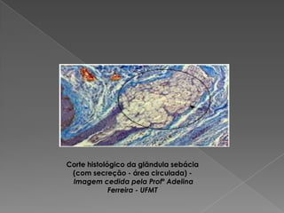Corte histológico da glândula sebácia
(com secreção - área circulada) -
Imagem cedida pela Profº Adelina
Ferreira - UFMT
 