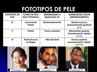 FOTOTIPOS DE PELE
FOTOTIPOS DE
PELE
CORES DE PELE
NÃO EXPOSTAS
SENSIBILIDADE A
RADIAÇÃO UV
QUEIMADURA SOLAR
(BRONZEAMENTO)
IV Levemente
Parda
Moderadamente Queima pouco
bronzeamento gradual
(++)
V Parda Pouco sensível Raramente queima
bronzeamento rápido
(+++)
VI Parda Escura
ou Negra
Não Sensível Nunca queima
bronzeamento rápido
(++++)
 