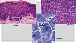 basal granuloso
espinhoso
 
