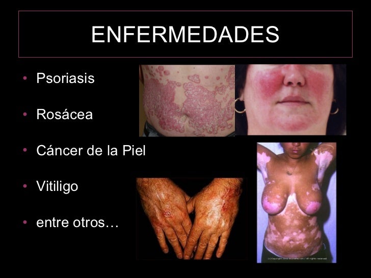 Sistema Tegumentario