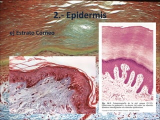 2.- Epidermis e) Estrato Córneo 