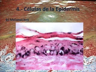 4.- Células de la Epidermis b) Melanocitos 