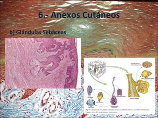 6.- Anexos Cutáneos b) Glándulas Sebáceas 