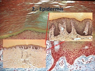 2.- Epidermis 
