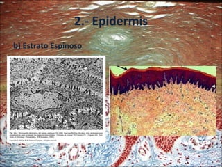 2.- Epidermis b) Estrato Espinoso 