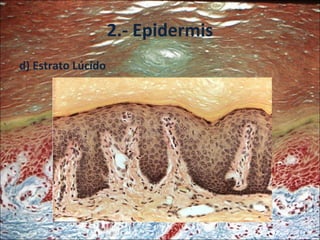 2.- Epidermis <ul><li>d) Estrato Lúcido </li></ul>