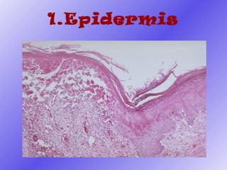 Epidermis  