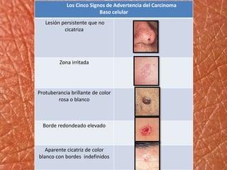 Sistema tegumentario | PPTX