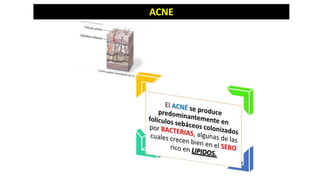 ACNE

 