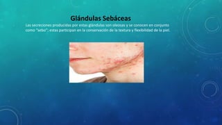 Glándulas Sebáceas
Las secreciones producidas por estas glándulas son oleosas y se conocen en conjunto
como “sebo”; estas participan en la conservación de la textura y flexibilidad de la piel.
 