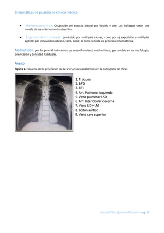 Sistemáticas de guardia de clínica médica
Hospital Dr. Ignacio Pirovano I pág. 23
 Hidroneumotórax: Ocupación del espacio...