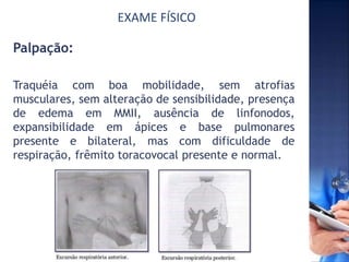 EXAME FÍSICO
Palpação:
Traquéia com boa mobilidade, sem atrofias
musculares, sem alteração de sensibilidade, presença
de edema em MMII, ausência de linfonodos,
expansibilidade em ápices e base pulmonares
presente e bilateral, mas com dificuldade de
respiração, frêmito toracovocal presente e normal.
 