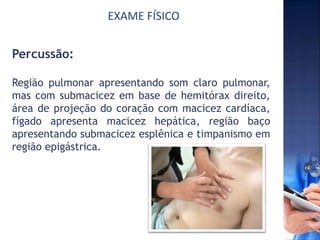 EXAME FÍSICO
Percussão:
Região pulmonar apresentando som claro pulmonar,
mas com submacicez em base de hemitórax direito,
área de projeção do coração com macicez cardíaca,
fígado apresenta macicez hepática, região baço
apresentando submacicez esplênica e timpanismo em
região epigástrica.
 
