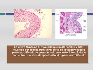   La uretra femenina es más corta que la del hombre y está revestida por epitelio transicional cerca de la vejiga y epitelio plano estratificado no queratinizado en el resto. Intercaladas se encuentran manchas de epitelio cilíndrico pseudoestratificado.