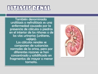 LITIASIS RENAL   También denominada urolitiasis o nefrolitiasis es una enfermedad causada por la presencia de cálculos o piedras en el interior de los riñones o de las vías urinarias (uréteres, vejiga).Los cálculos renales se componen de sustancias normales de la orina, pero por diferentes razones se han concentrado y solidificado en fragmentos de mayor o menor tamaño. 