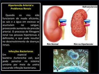 Hipertensão Arterial e
Problemas Renais
Quando os rins não
funcionam de modo eficiente,
os sais e a água em excesso se
acumulam no sangue,
provocando aumento da pressão
arterial. O processo de filtragem
renal nas pessoas hipertensas é
deficiente, o que pode resultar
no desenvolvimento de doenças
renais.
Infecções Bacterianas
Em especial a
bactéria Escherichia coli, que
pode penetrar no sistema
urinário por meio da uretra
causando infecção bacteriana.
 