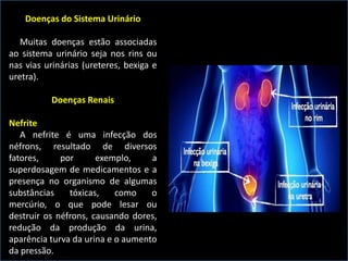 Doenças do Sistema Urinário
Muitas doenças estão associadas
ao sistema urinário seja nos rins ou
nas vias urinárias (ureteres, bexiga e
uretra).
Doenças Renais
Nefrite
A nefrite é uma infecção dos
néfrons, resultado de diversos
fatores, por exemplo, a
superdosagem de medicamentos e a
presença no organismo de algumas
substâncias tóxicas, como o
mercúrio, o que pode lesar ou
destruir os néfrons, causando dores,
redução da produção da urina,
aparência turva da urina e o aumento
da pressão.
 
