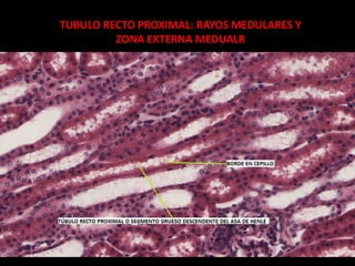 SISTEMA RENAL | PPTX