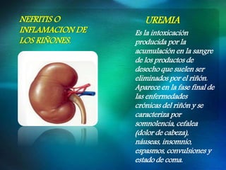 Es la intoxicación
producida por la
acumulación en la sangre
de los productos de
desecho que suelen ser
eliminados por el riñón.
Aparece en la fase final de
las enfermedades
crónicas del riñón y se
caracteriza por
somnolencia, cefalea
(dolor de cabeza),
náuseas, insomnio,
espasmos, convulsiones y
estado de coma.
NEFRITIS O
INFLAMACION DE
LOS RIÑONES.
UREMIA
 
