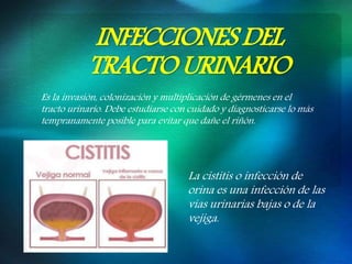 INFECCIONES DEL
TRACTO URINARIO
Es la invasión, colonización y multiplicación de gérmenes en el
tracto urinario. Debe estudiarse con cuidado y diagnosticarse lo más
tempranamente posible para evitar que dañe el riñón.
La cistitis o infección de
orina es una infección de las
vías urinarias bajas o de la
vejiga.
 