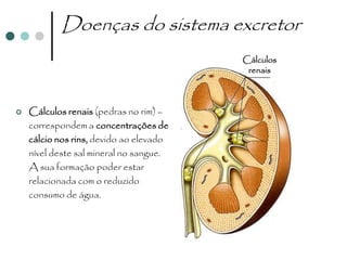 Doenças do sistema excretor
                                         Cálculos
                                          renais



   Cálculos renais (pedras no rim) –
    correspondem a concentrações de
    cálcio nos rins, devido ao elevado
    nível deste sal mineral no sangue.
    A sua formação poder estar
    relacionada com o reduzido
    consumo de água.
 