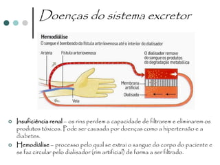 Doenças do sistema excretor




   Insuficiência renal – os rins perdem a capacidade de filtrarem e eliminarem os
    produtos tóxicos. Pode ser causada por doenças como a hipertensão e a
    diabetes.
   Hemodiálise – processo pelo qual se extrai o sangue do corpo do paciente e
    se faz circular pelo dialisador (rim artificial) de forma a ser filtrado.
 