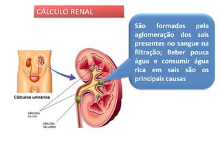 São formadas pela
aglomeração dos sais
presentes no sangue na
filtração; Beber pouca
água e consumir água
rica em sais são os
principais causas

 