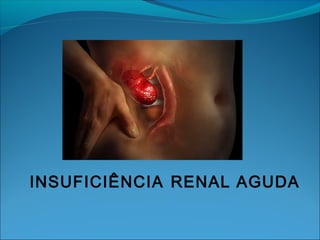 INSUFICIÊNCIA RENAL AGUDA
 