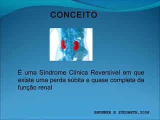 CONCEITO
É uma Síndrome Clínica Reversível em que
existe uma perda súbita e quase completa da
função renal
BRUNNER E SUDDARTH,2008
 