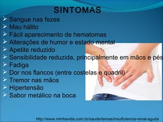 SINTOMAS
 Sangue nas fezes
 Mau hálito
 Fácil aparecimento de hematomas
 Alterações de humor e estado mental
 Apetite reduzido
 Sensibilidade reduzida, principalmente em mãos e pés
 Fadiga
 Dor nos flancos (entre costelas e quadril)
 Tremor nas mãos
 Hipertensão
 Sabor metálico na boca
http://www.minhavida.com.br/saude/temas/insuficiencia-renal-aguda
 