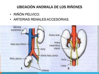 UBICACIÓN ANOMALA DE LOS RIÑONES
• RIÑÓN PELVICO:
• ARTERIAS RENALES ACCESORIAS.
 