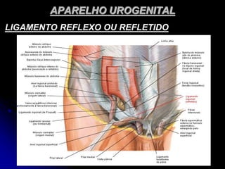 APARELHO UROGENITAL
LIGAMENTO REFLEXO OU REFLETIDO
 