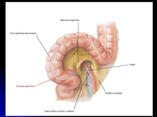 APARELHO UROGENITAL
URETER
PARTE ABDOMIANAL
URETER “E”
É cruzado pelos vasos Cólicos Esquerdos.
Nas proximidades da abertura superior da pelve,
passa posteriormente ao Colo Sigmóide.
 