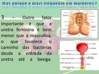 3 - Outro fator
importante é que a
uretra feminina é bem
menor que a masculina,
o que favorece o
caminho das bactérias
desde a entrada da
uretra até a bexiga.
 